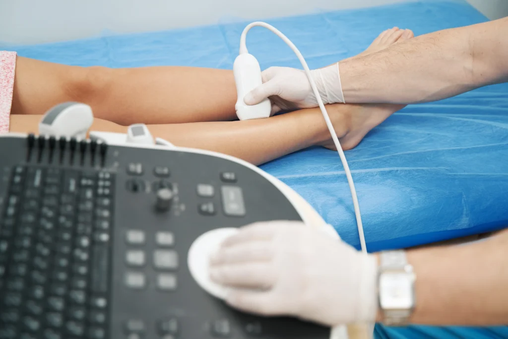 Best Treatments for Varicose Veins in Maple Lawn, MD