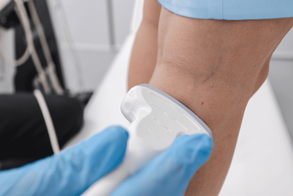 Best Treatments for Venous Insufficiency in Maple Lawn, MD