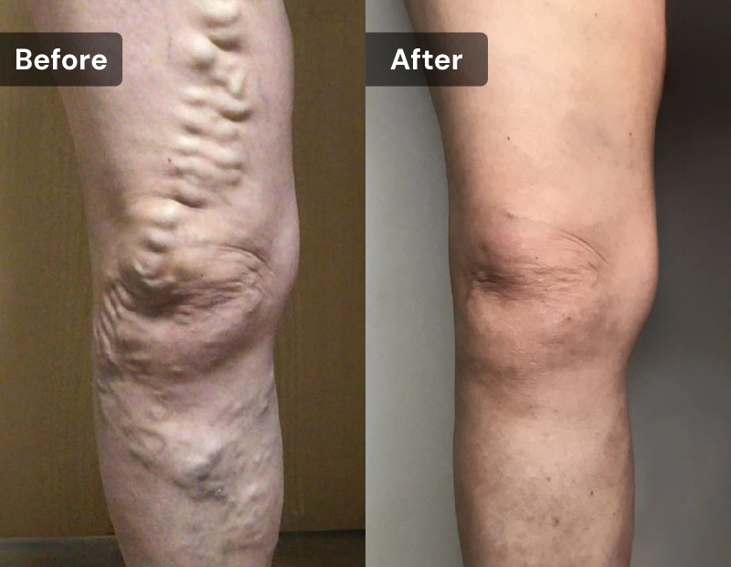 VCLNY & VTC NY Banners BA Horizontal VCLNY & VTC NY Banners BA Horizontal